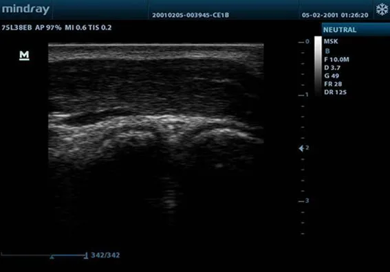Клинические изображения УЗИ аппарат Mindray M9T портативный