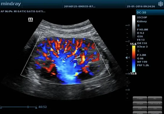 Клинические изображения Mindray M5