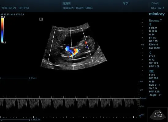 Клинические изображения УЗИ аппарат Mindray Resona 7