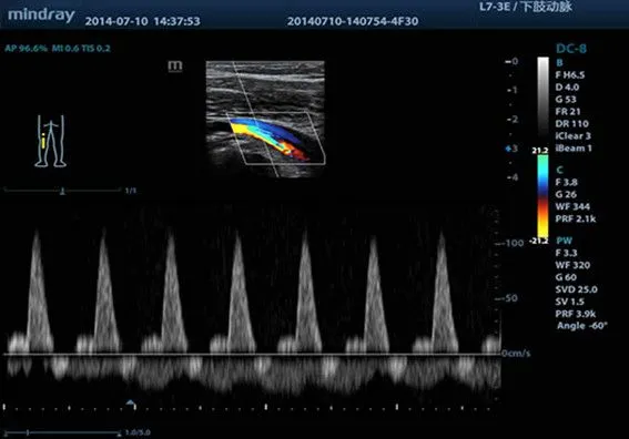 Клинические изображения УЗИ аппарат Mindray DC-8 Exp
