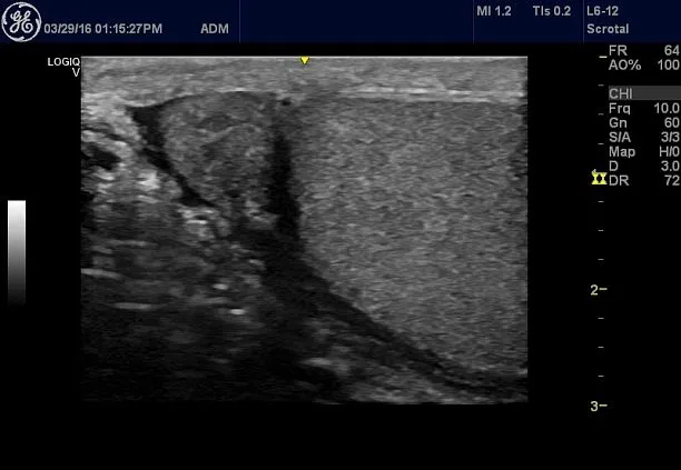 Клинические изображения УЗИ аппарат GE HealthCare Vscan Air карманный