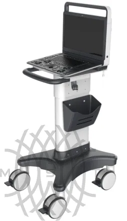 Sonoscape E3 ультразвуковой аппарат