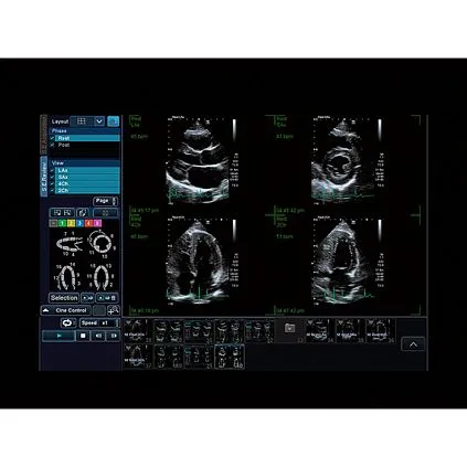 Клинические изображения Canon (Toshiba) Xario 200G аппарат УЗИ