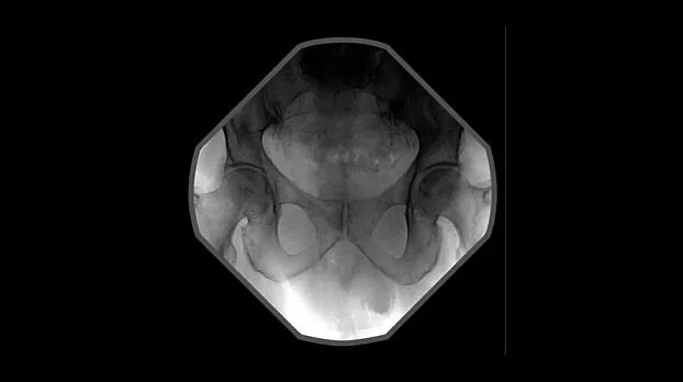 Клинические изображения Рентгенохирургический аппарат типа С-дуга GE OEC Elite CFD