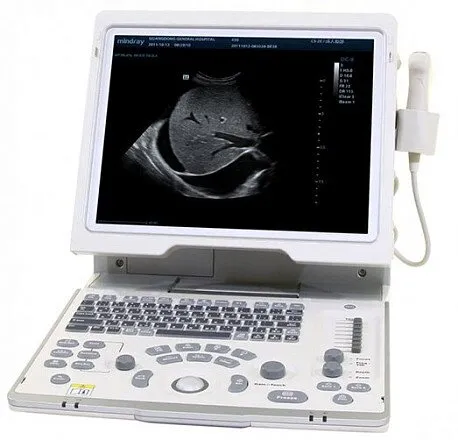 УЗИ аппарат Mindray DP-50 портативный