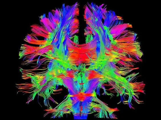 Клинические изображения Магнитно-резонансный томограф Siemens MAGNETOM Prisma 3T