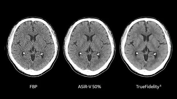 Клинические изображения Компьютерный томограф GE Revolution Ascend