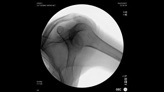 Клинические изображения Рентгенохирургический аппарат типа С-дуга GE OEC Elite II