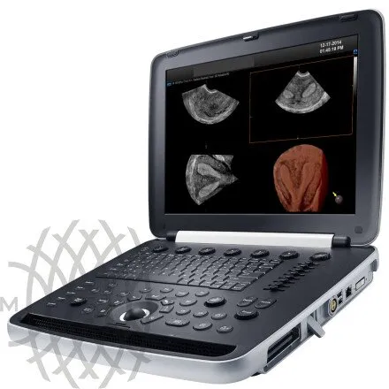 Samsung Medison HM70 EVO УЗИ аппарат портативный