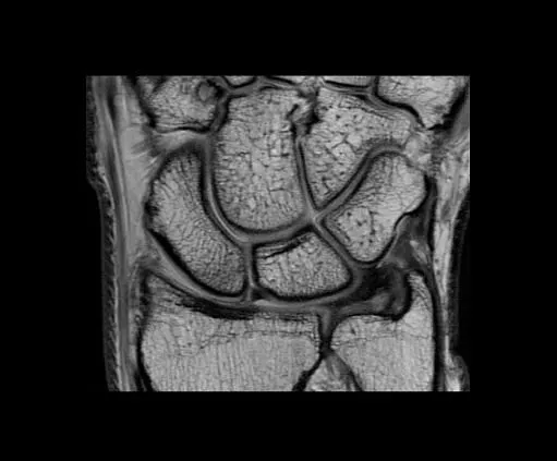 Клинические изображения МРТ аппарат GE SIGNA Architect 3T