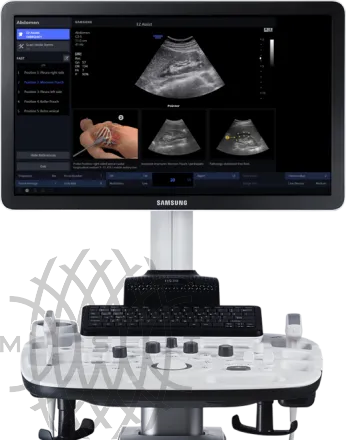 Samsung Medison HS30 УЗИ аппарат