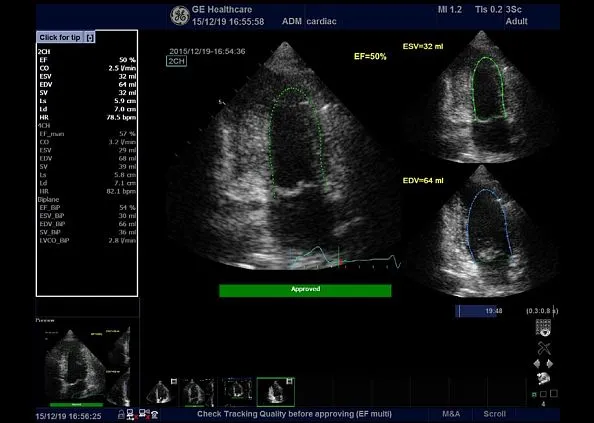 Клинические изображения Ультразвуковая диагностическая система GE HealthCare Vivid T8