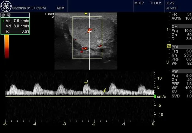 Клинические изображения УЗИ аппарат GE HealthCare Vscan Air карманный