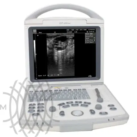 УЗИ аппарат Mindray DP-20 Vet ветеринарный портативный