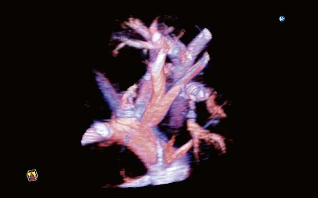 Клинические изображения Canon (Toshiba) Aplio i700 аппарат УЗИ