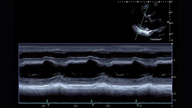 Клинические изображения Canon (Toshiba) Aplio i900 аппарат УЗИ