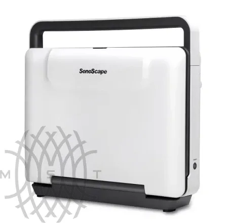 Sonoscape E3 ультразвуковой аппарат