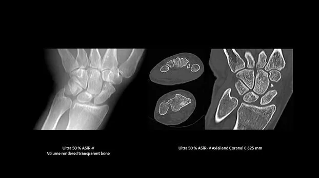 Клинические изображения GE HealthCare Revolution EVO компьютерный томограф