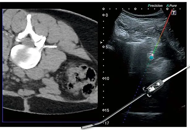 Клинические изображения Canon (Toshiba) Aplio 500 УЗИ аппарат
