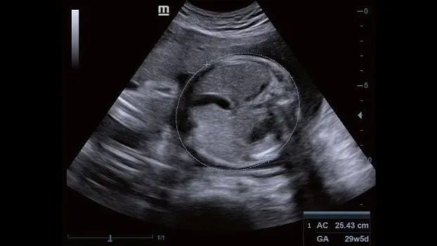 Клинические изображения УЗИ аппарат Mindray DC-40 Pro