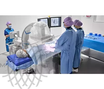 Philips Zenition 70 C-дуга