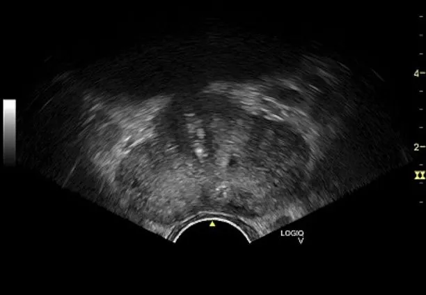 Клинические изображения УЗИ аппарат GE HealthCare Vscan Air карманный