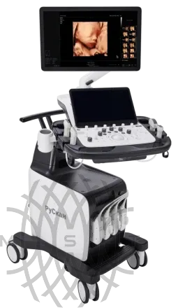 УЗИ аппарат РуСкан 80