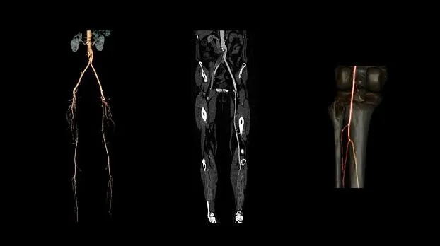 Клинические изображения GE Optima CT520 компьютерный томограф