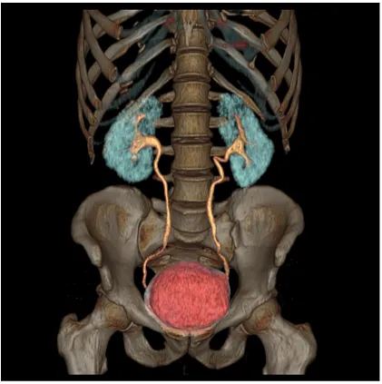 Клинические изображения Компьютерный томограф GE Optima CT540