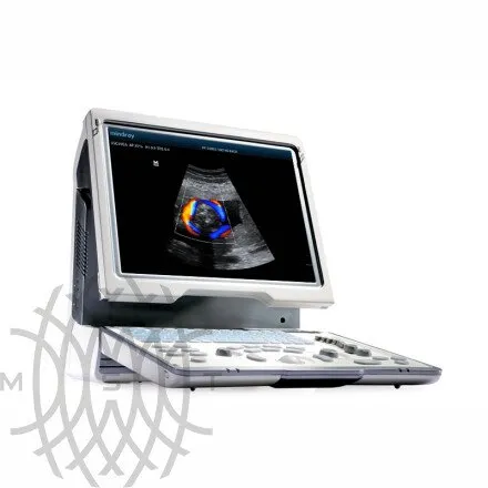 УЗИ аппарат Mindray DP-50 Color портативный