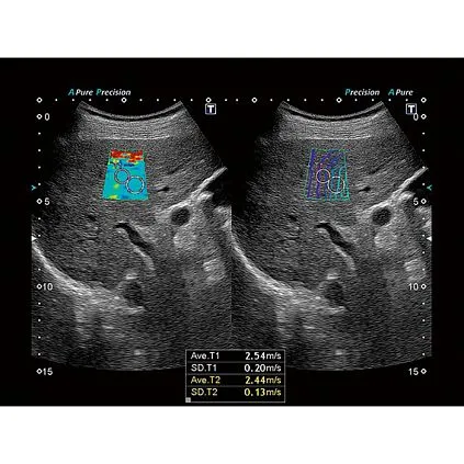 Клинические изображения Canon (Toshiba) Xario 200G аппарат УЗИ