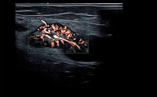 Клинические изображения Canon (Toshiba) Aplio i700 аппарат УЗИ