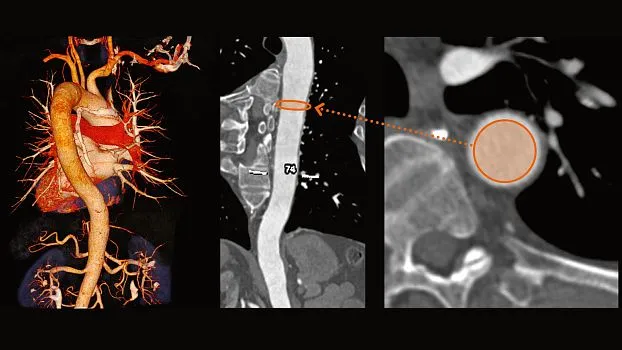 Клинические изображения Siemens SOMATOM go.Up компьютерный томограф
