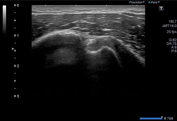 Клинические изображения Canon Xario 100 ультразвуковой аппарат