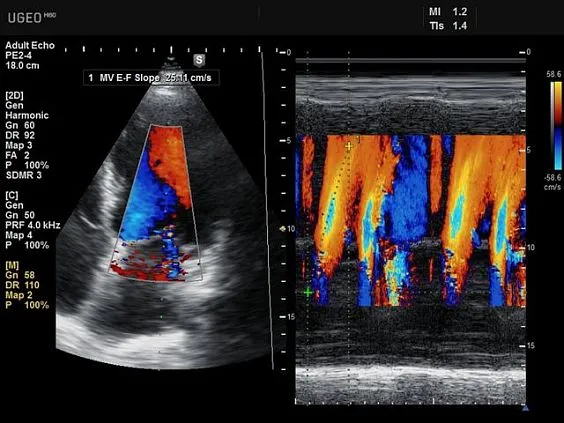 Клинические изображения Samsung Medison UGEO H60 УЗИ аппарат