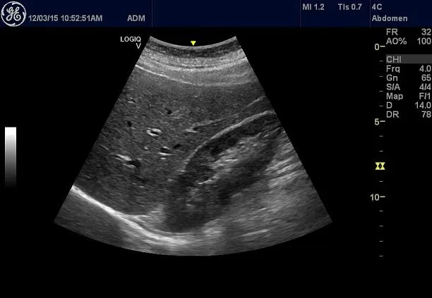 Клинические изображения УЗИ аппарат GE HealthCare Vscan Air карманный