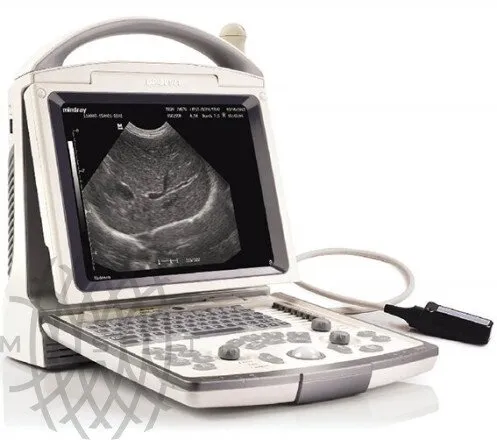 УЗИ аппарат Mindray DP-30 Vet портативный ветеринарный