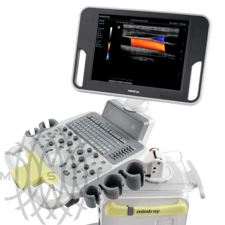 УЗИ аппарат Mindray DC-N3