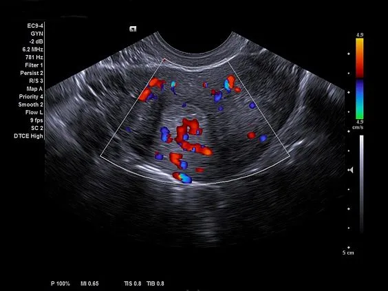 Клинические изображения Siemens Acuson NX2 Elite аппарат УЗИ