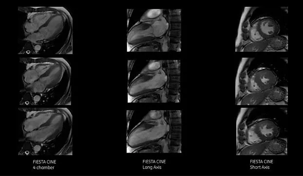 Клинические изображения МРТ аппарат GE SIGNA Voyager 1.5T