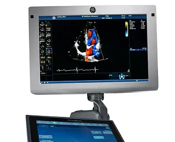 Ультразвуковая диагностическая система GE Vivid S60