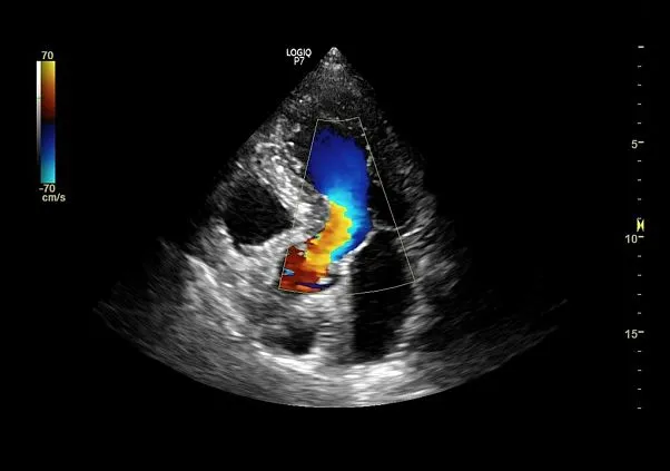 Клинические изображения GE Logiq P9 ультразвуковая диагностическая система