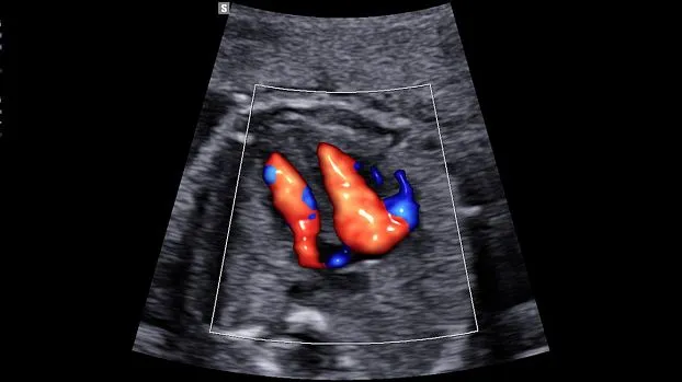 Клинические изображения Samsung Medison W10 УЗИ аппарат