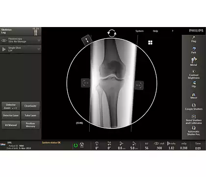 Клинические изображения Philips Veradius Unity С-дуга