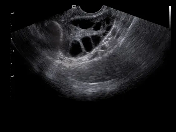 Клинические изображения УЗИ аппарат НПО Сканер РуСкан 50