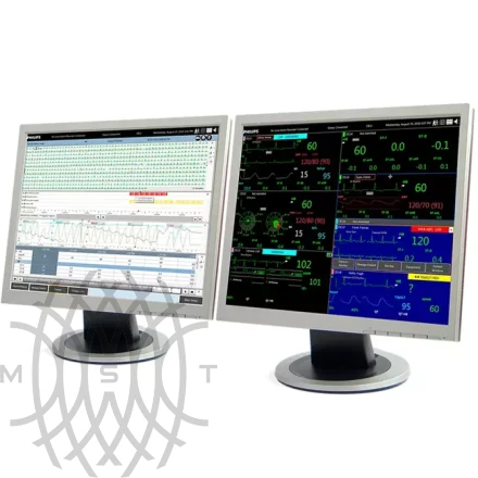 Центральная станция мониторинга Philips IntelliVue iX