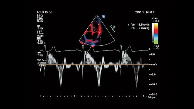 Клинические изображения Philips Affiniti 30 ультразвуковой аппарат