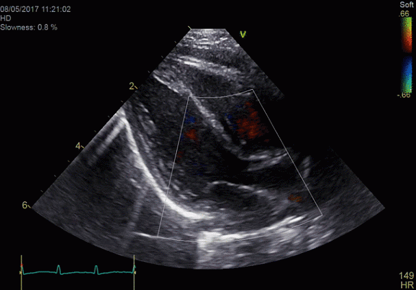 Клинические изображения УЗИ аппарат GE HealthCare Vivid E90