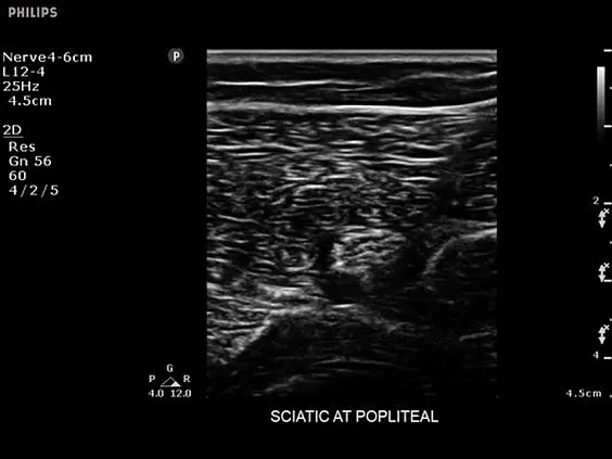 Клинические изображения Philips Sparq ультразвуковой аппарат