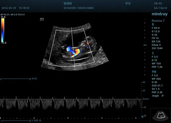 Клинические изображения УЗИ аппарат Mindray Resona 7s